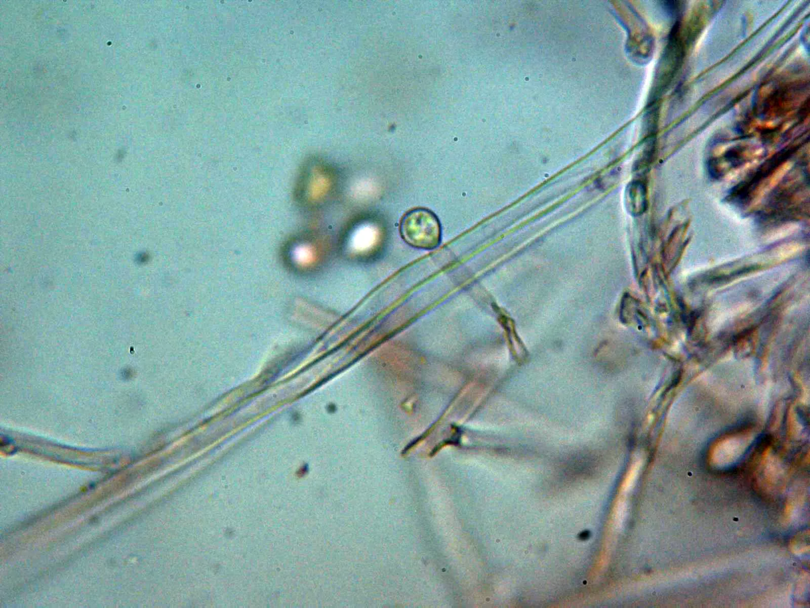 Microscopía de Xenasmatella alnicola - 10 - Conidióforo 2